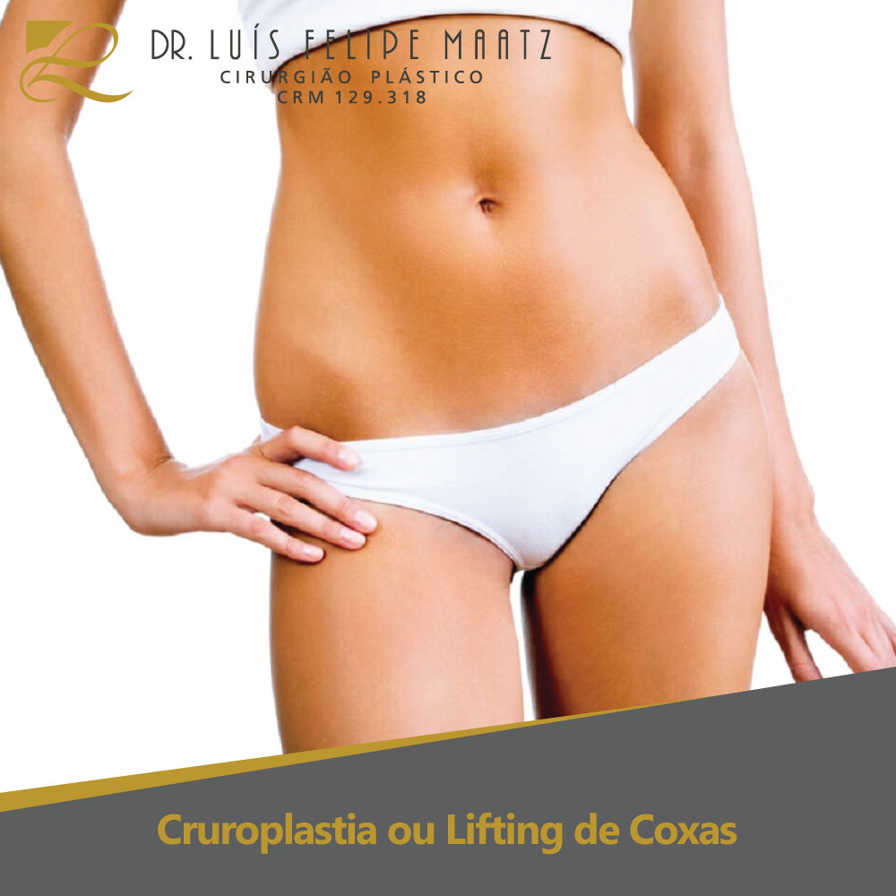 Cruroplastia ou Lifting de Coxa - Clínica de cirurgia plástica Dr. Luís Maatz, localizada na cidade de Jundiaí.