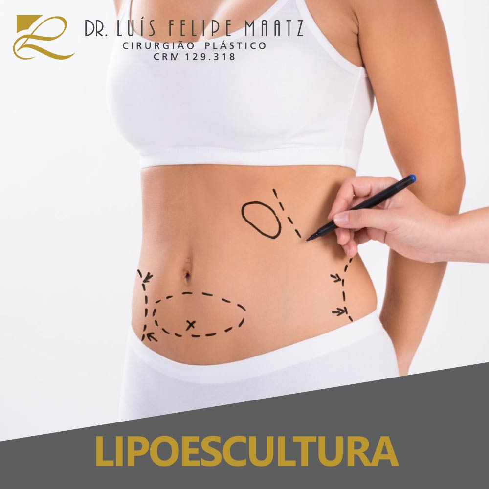 Cirurgia Plástica Lipoescultura - Clínica de cirurgia plástica Dr. Luís Maatz, localizada na cidade de Jundiaí.
