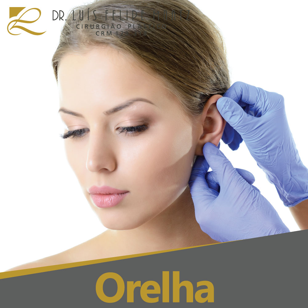 Cirurgia Plástica Otoplastia - Clínica de cirurgia plástica Dr. Luís Maatz, localizada na cidade de Jundiaí.